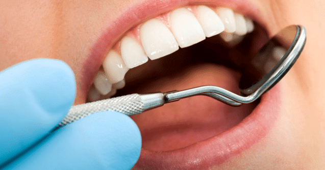 What is a Tooth Filling? White Tooth Fillings are Healthy and Durable